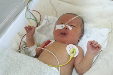 Cháu bé 3 ngày tuổi có nhịp tim chậm tính bằng phút