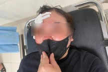 Triệu tập người trên ô tô bán tải bị tố vụt dùi cui vào đầu nữ tài xế