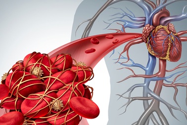Bệnh tiểu đường type 2 và những điều thể bạn chưa biết