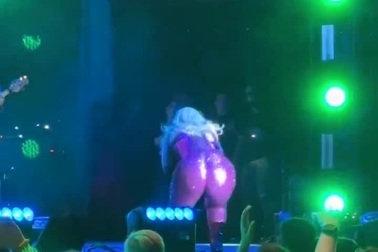 Nữ ca sĩ Bebe Rexha bị ném điện thoại vào mặt, phải đi khâu 3 mũi