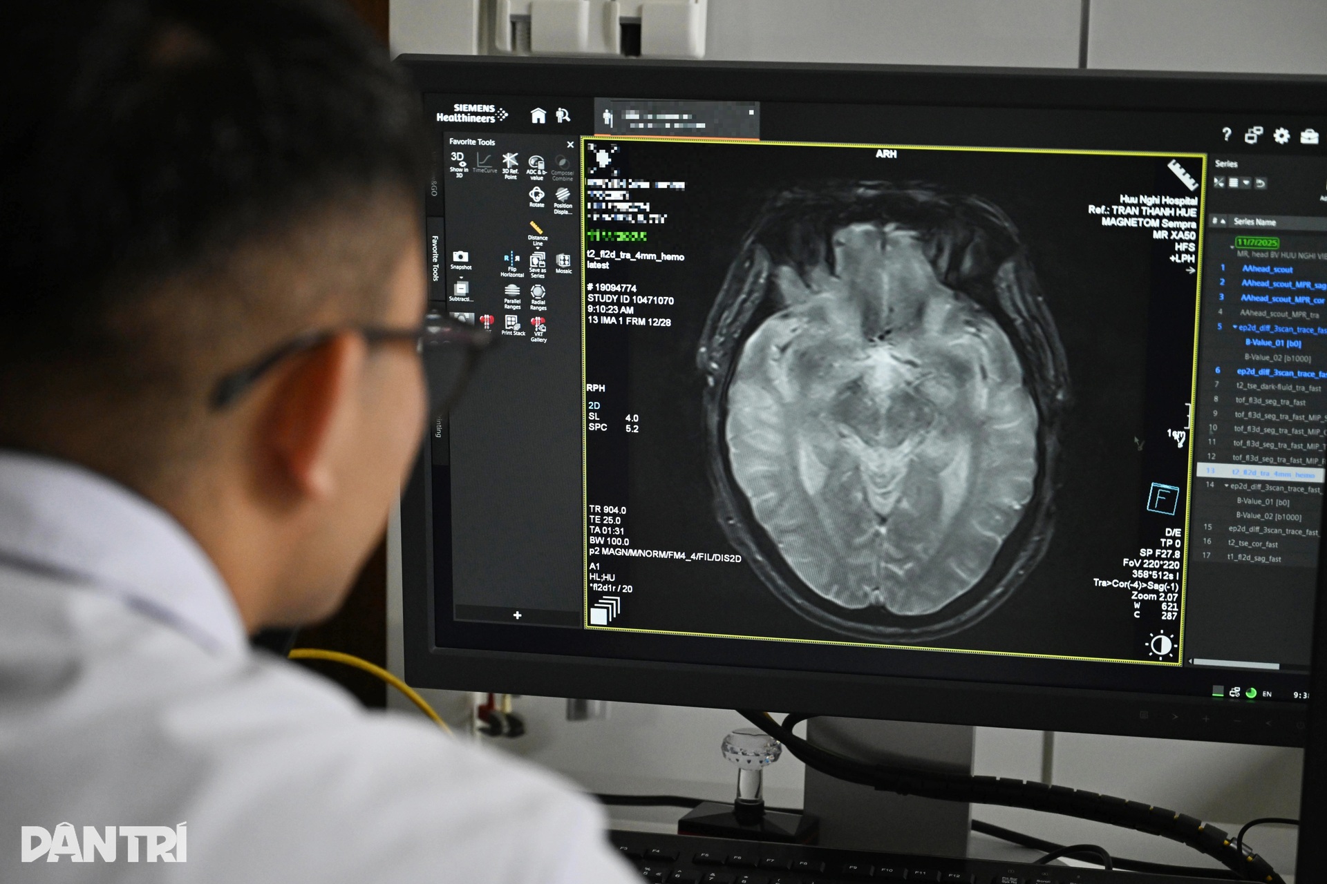 Nín thở xem bác sĩ giải cứu bộ não sắp chết ngạt của bệnh nhân đột quỵ - 2