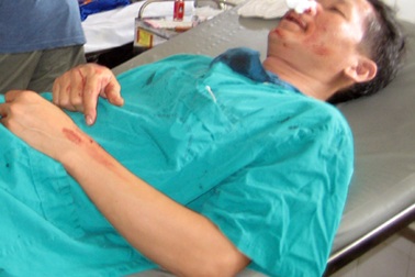 “Bỏ bệnh nhân trên bàn mổ để đánh nhau là không thể chấp nhận”