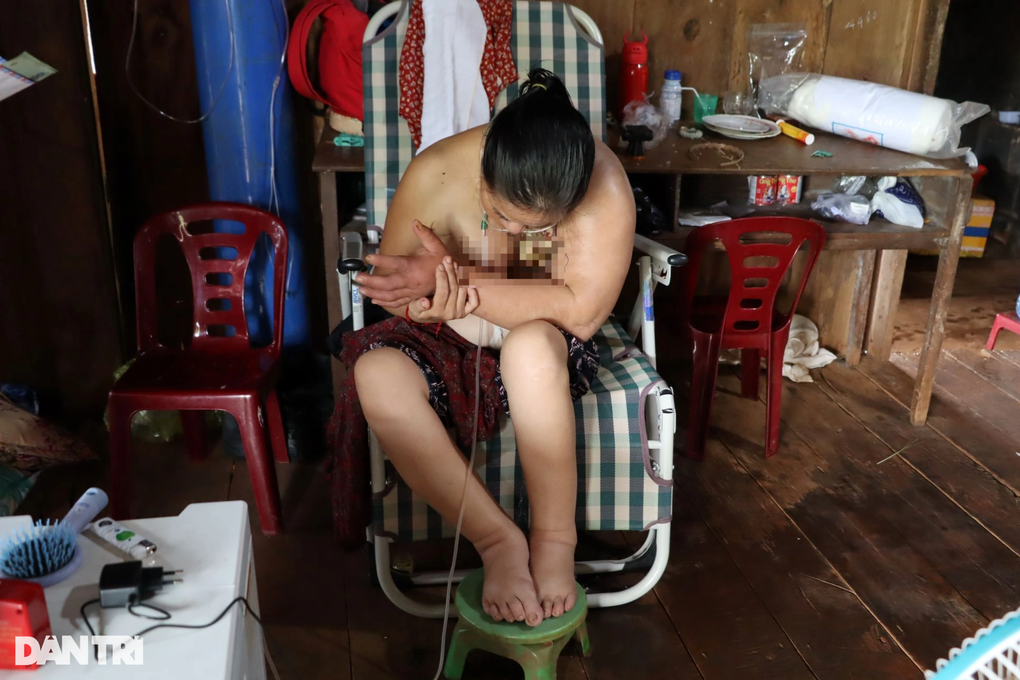 Người phụ nữ gục trên ghế nhiều tháng ròng vì ung thư vú di căn - 1 Người phụ nữ gục trên ghế nhiều tháng ròng vì ung thư vú di căn - 1