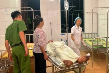 Nam thanh niên bị chém nhiều nhát khi đang đi trên đường