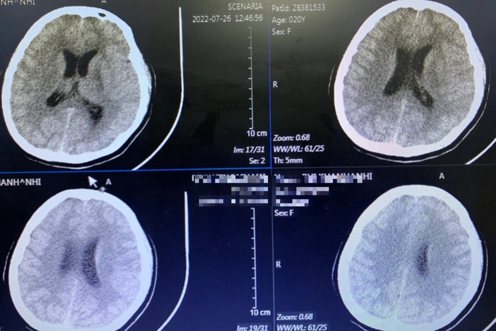 Giới trẻ nghiện hút vape: Hiểm họa đằng sau làn khói sành điệu mỏng manh - 2 Giới trẻ nghiện hút vape: Hiểm họa đằng sau làn khói sành điệu mỏng manh - 2