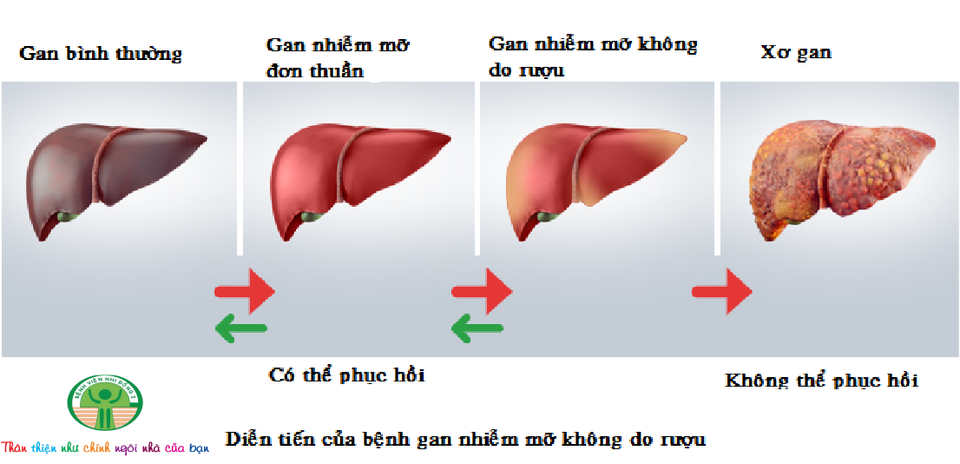 Bé trai mới 8 tuổi đã bị gan nhiễm mỡ - 2 Bé trai mới 8 tuổi đã bị gan nhiễm mỡ - 2