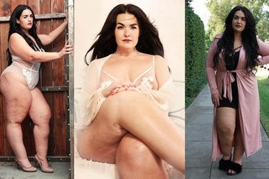 Chân phù da rạn, người mẫu nội y vẫn tự tin thả dáng