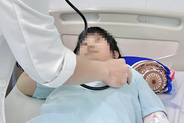 Trẻ liên tục gặp nạn mùa hè: Ong đốt, rắn cắn, té xe đạp phải mổ