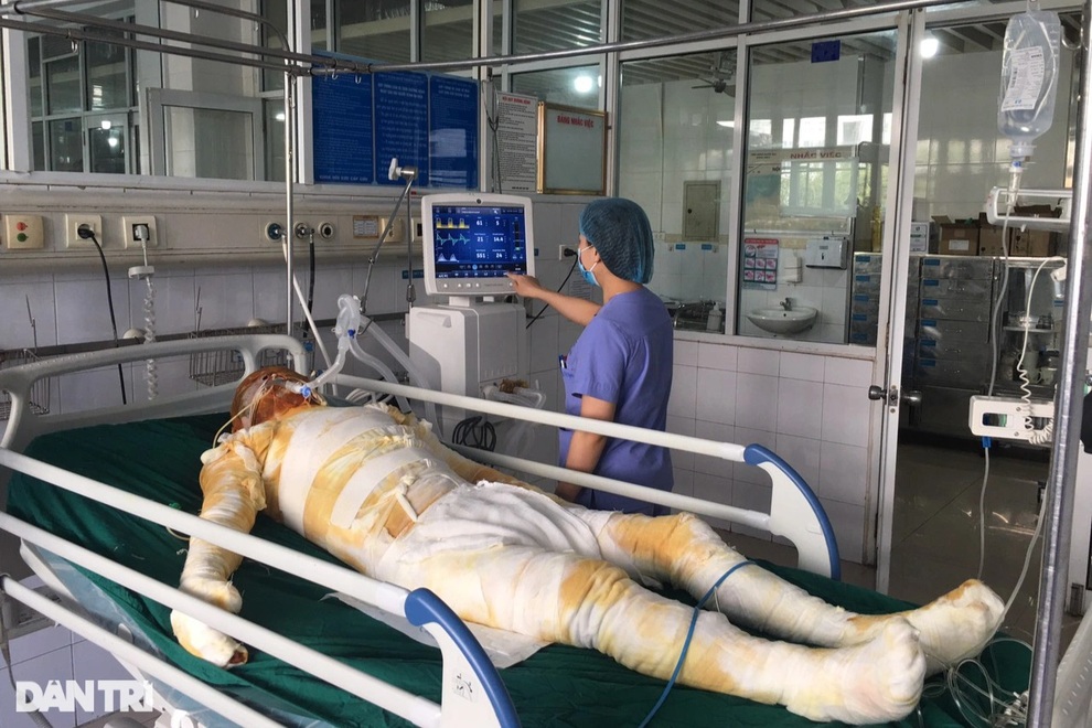 Lao vào biển lửa cứu con, tính mạng 2 bố con đang vô cùng nguy kịch - 1 Lao vào biển lửa cứu con, tính mạng 2 bố con đang vô cùng nguy kịch - 1