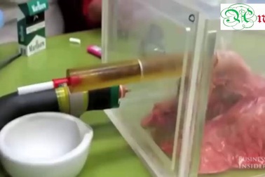 Hình ảnh lá phổi bị ám khói đen kịt sau khi hút thuốc lá.