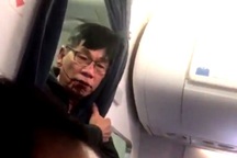 Sếp United Airlines bị chất vấn trước Quốc hội Mỹ vì vụ bác sĩ gốc Việt