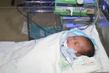 Mổ mắt thành công cho bé gái thứ 2 trong ca sinh 4