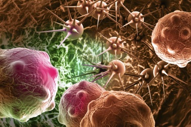 Hội chứng cận ung thư là gì?