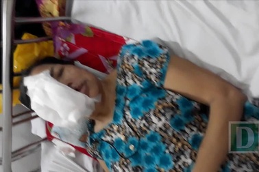 Vì không có tiền đi bệnh viện nên bà đào để khối u ăn lan hết nửa khuôn mặt