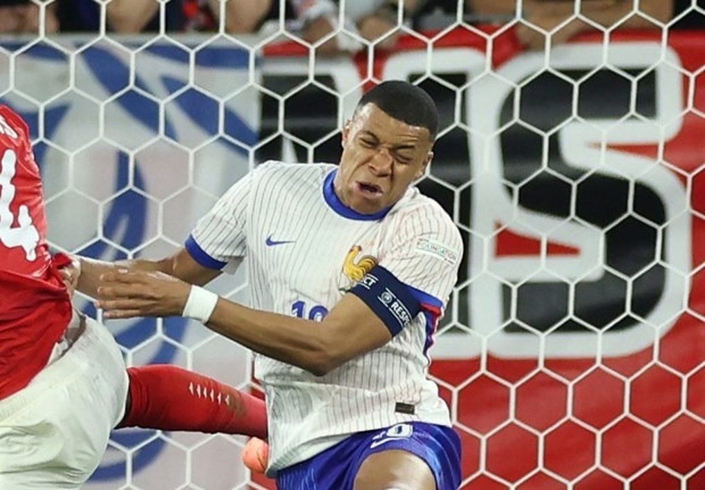 Mbappe nhập viện cấp cứu sau pha gãy mũi ở Euro 2024 - 2