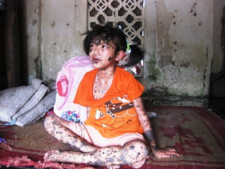 Gặp lại bé gái mơ một ngày được làm thiếu nữ - 1 Gặp lại bé gái mơ một ngày được làm thiếu nữ - 1