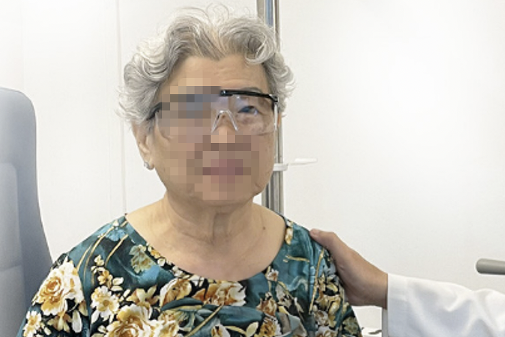 Căn bệnh hiểm khiến mắt người phụ nữ có màu vàng và nâu đen, nguy cơ mù lòa - 2 Căn bệnh hiểm khiến mắt người phụ nữ có màu vàng và nâu đen, nguy cơ mù lòa - 2