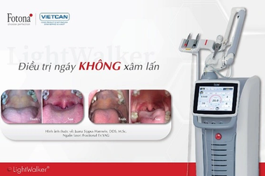 Cải thiện ngủ ngáy với laser LightWalker