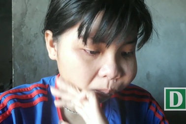 Nữ sinh 8 năm chống chọi với bệnh tật mong có tiền phẫu thuật khối u trên mặt