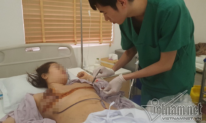 Người phụ nữ Sài Gòn 31 tuổi khổ sở vì ngực dài nửa mét - Ảnh 4.