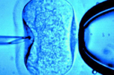 IQ của trẻ giảm nếu dùng phương pháp hỗ trợ sinh sản?