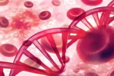 4 lưu ý khi chế biến thực phẩm cho bệnh nhân ung thư máu