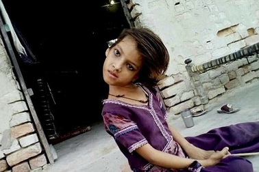 Cô bé "chỉ nhìn thôi đã mỏi": Đầu cổ luôn cong vẹo 90 độ đến mức không đi được