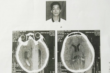 Nam sinh bị đánh chấn thương não: Phục hồi điều tra sau giám định lần 2