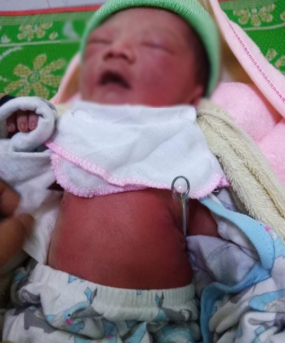 Bé gái sơ sinh còn nguyên dây rốn bị bỏ ở rẫy bắp - 2