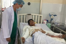 Bị điện cao thế phóng, nam thanh niên nguy cơ phải đoạn chi