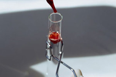 Thử máu cho phép phát hiện bệnh trầm cảm sau sinh