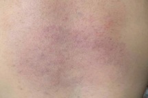 Công an điều tra vụ cháu bé nghi bị bạo hành ở nhóm giữ trẻ tại Bình Thuận