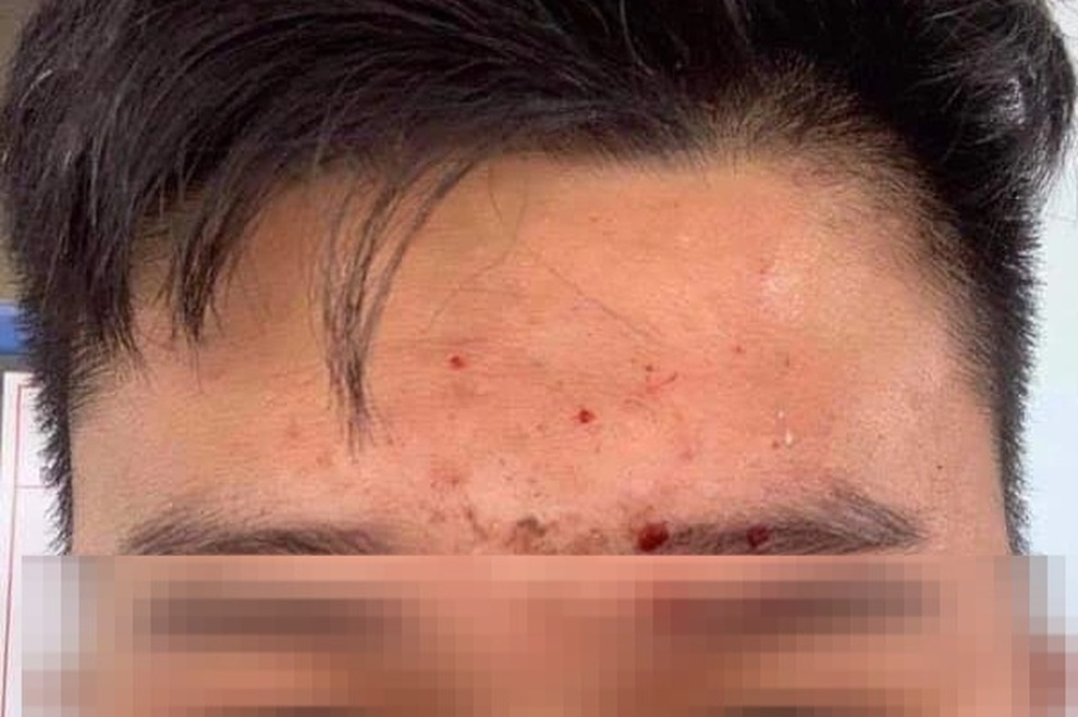 Công an vào cuộc vụ nguyên phó chủ tịch huyện ném sầu riêng - 2 Công an vào cuộc vụ nguyên phó chủ tịch huyện ném sầu riêng - 2