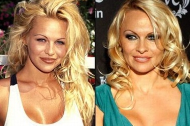 Sao biến đổi thế nào sau phẫu thuật thẩm mỹ?