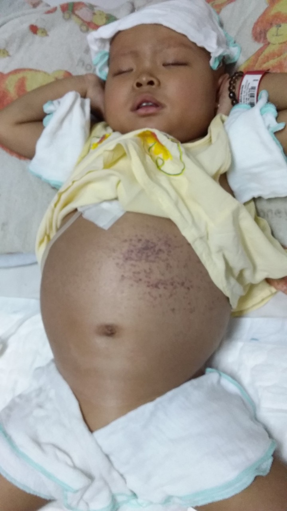 Người mẹ nghèo đôi dòng nước mắt nghẹn ngào cầu xin sự sống cho con - 2 Người mẹ nghèo đôi dòng nước mắt nghẹn ngào cầu xin sự sống cho con - 2