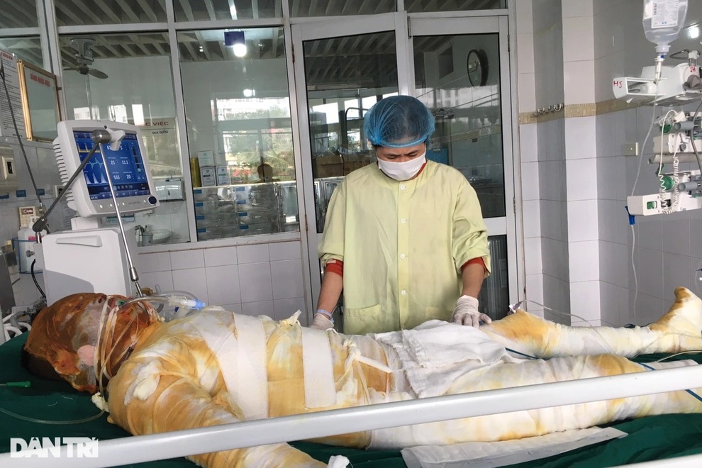 Lao vào biển lửa cứu con, tính mạng 2 bố con đang vô cùng nguy kịch - 5 Lao vào biển lửa cứu con, tính mạng 2 bố con đang vô cùng nguy kịch - 5