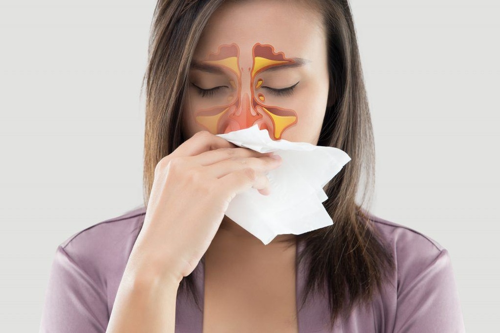 Ngạt mũi buổi sáng dùng thuốc gì? - 1 Ngạt mũi buổi sáng dùng thuốc gì? - 1