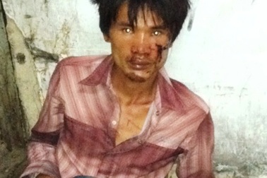 Khởi tố hung thủ cuồng sát về hành vi giết người 