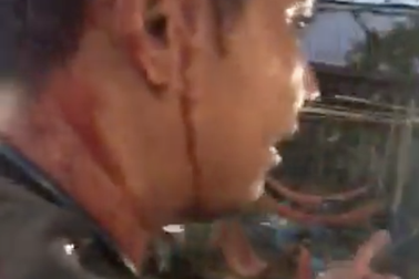 Hai du khách tố bị đánh vỡ đầu vì phản ứng chuyện "chặt chém"