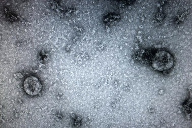 Sàng lọc nCoV, Việt Nam có khả năng xét nghiệm hàng nghìn mẫu mỗi ngày