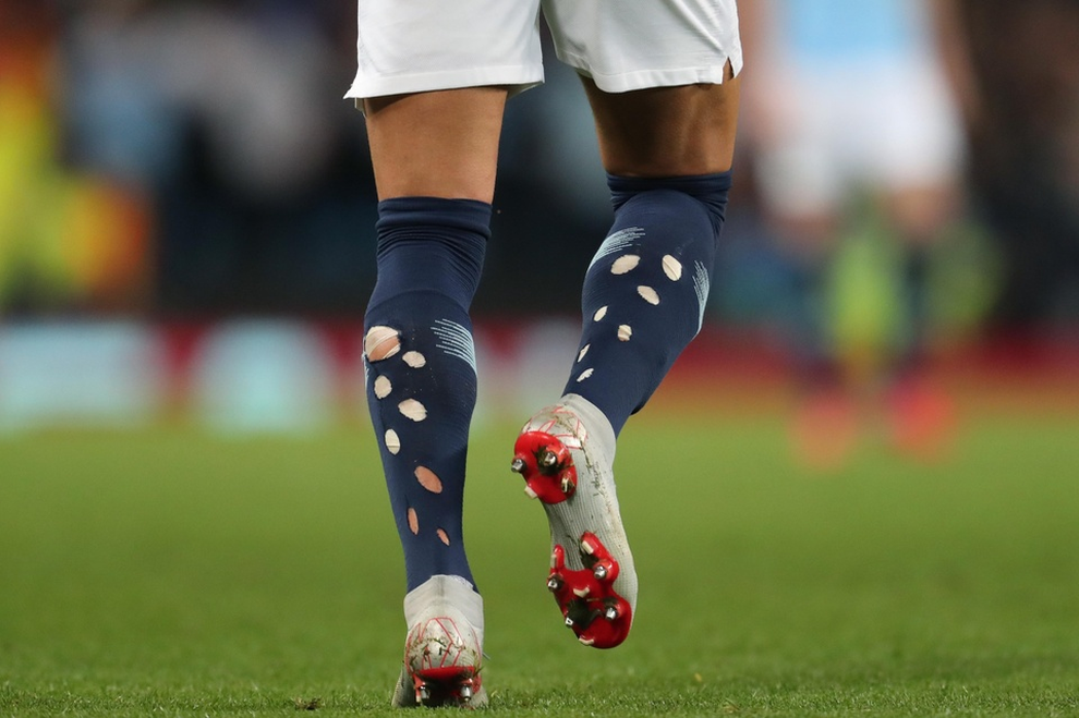 Bí mật phía sau những đôi tất rách khoét lỗ của cầu thủ Anh tại Euro 2024 - 3 Bí mật phía sau những đôi tất rách khoét lỗ của cầu thủ Anh tại Euro 2024 - 3