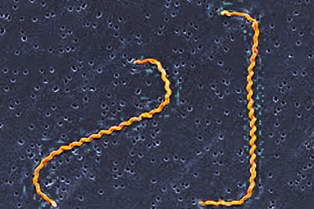 Tiếp xúc bùn đất ở khu cắm trại, chàng trai nhiễm xoắn khuẩn nguy hiểm - 2 Tiếp xúc bùn đất ở khu cắm trại, chàng trai nhiễm xoắn khuẩn nguy hiểm - 2