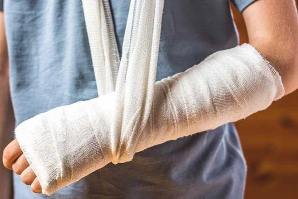Đắp lá cây chữa gãy tay, cháu bé bị hoại tử, nhiễm trùng huyết nặng - 1 Đắp lá cây chữa gãy tay, cháu bé bị hoại tử, nhiễm trùng huyết nặng - 1