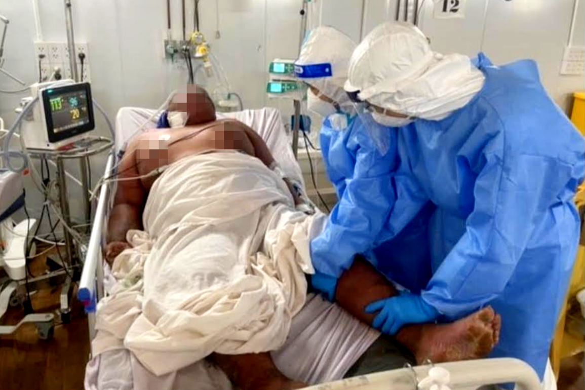84 ngày chạy ECMO cứu thần kỳ F0 nặng 140kg, viện phí 1,6 tỷ đồng - 2 84 ngày chạy ECMO cứu thần kỳ F0 nặng 140kg, viện phí 1,6 tỷ đồng - 2