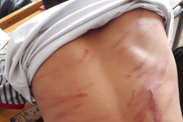 Vụ học sinh lớp 8 bị bố đánh dã man: Trận đòn “cắt” cơn nghiện game?