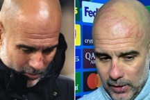 HLV Pep Guardiola tự cào rách mặt, giận dữ vì Man City rơi điểm không tưởng