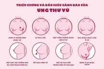 10 yếu tố làm tăng nguy cơ ung thư vú chị em cần lưu ý