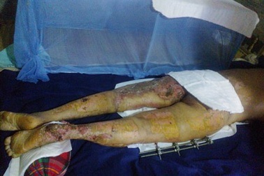 Tiếp tục trao hơn 7 triệu đồng đến chị Đặng Thị Huế