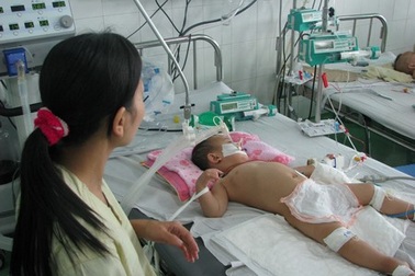 Hai ca tay chân miệng nặng phải thở máy