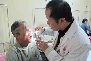 Cắt 2/3 lưỡi vì nghiện thuốc lá